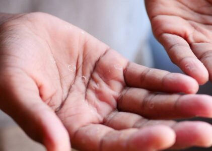 Adieu aux mains gercées : La révélation stupéfiante d’une dermatologue pour une peau douce et parfaite !
